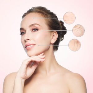 Rostro de mujer con las zonas donde se realiza el diagnóstico facial avanzado de la tecnología VISIA