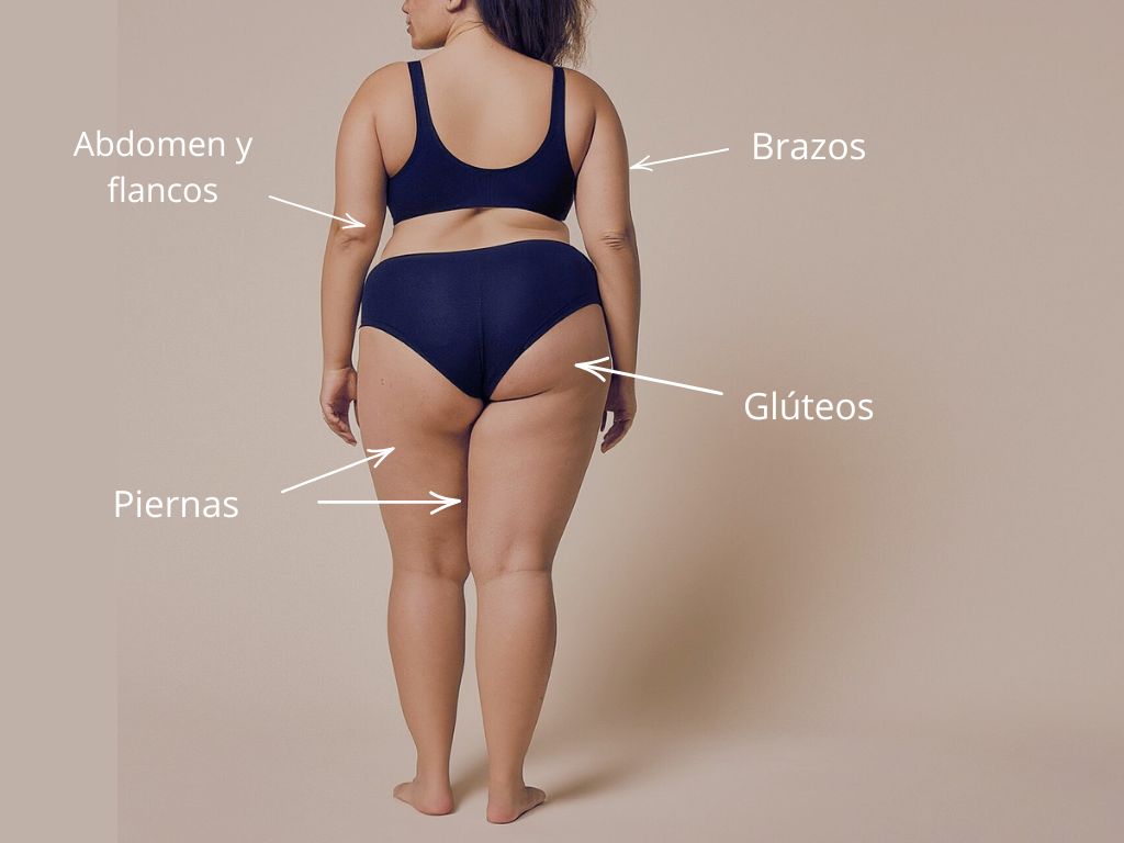 cuerpo de mujer de espaldas señalizando zonas de aplicación electroestimulación SlimUp